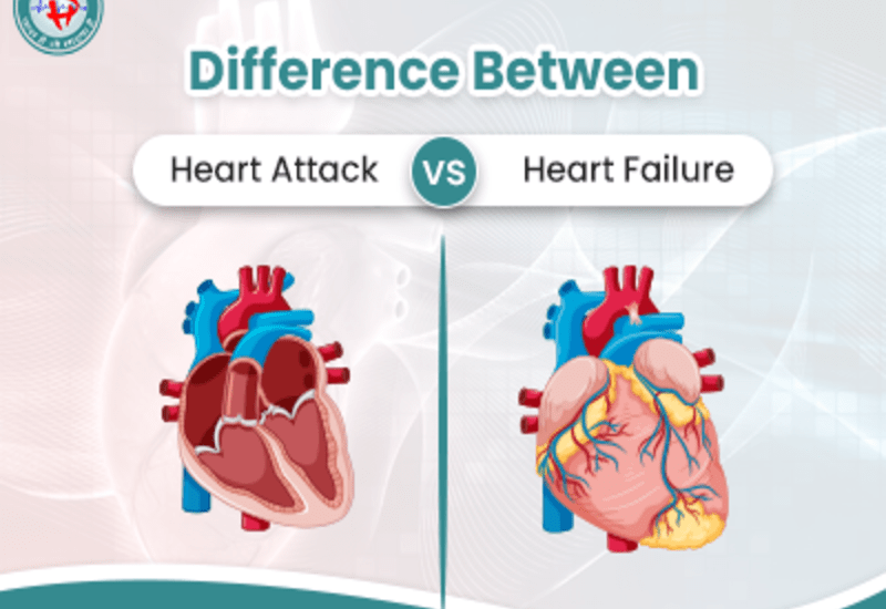 Difference Between Heart Attack and Heart Failure